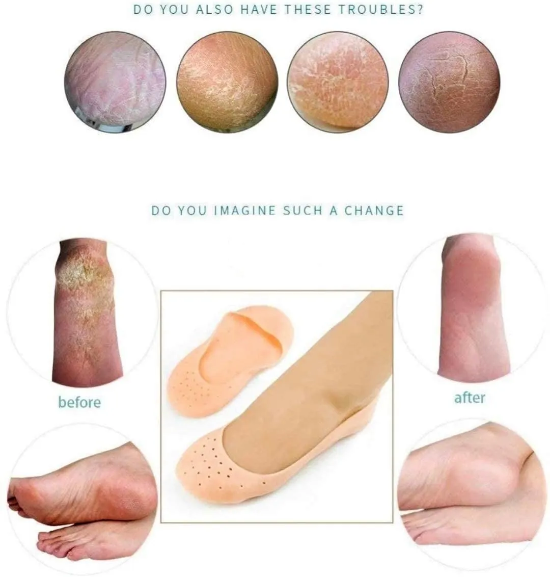 Anti Crack Silicone Socks